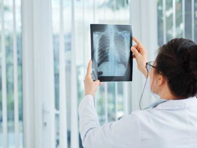 7 Early Warning Signs Lung Cancer