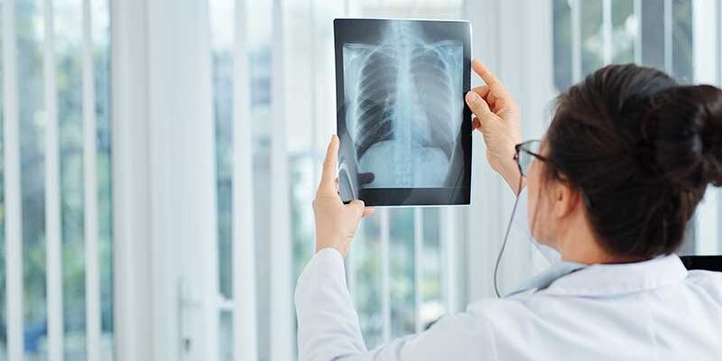 7 Early Warning Signs Lung Cancer