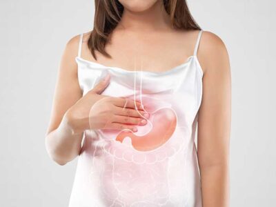 Managing Gastroesophageal Reflux Syndrome Lifestyle and Treatment